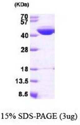 SDS-PAGE: Recombinant Human IVD His Protein [NBP1-40406]