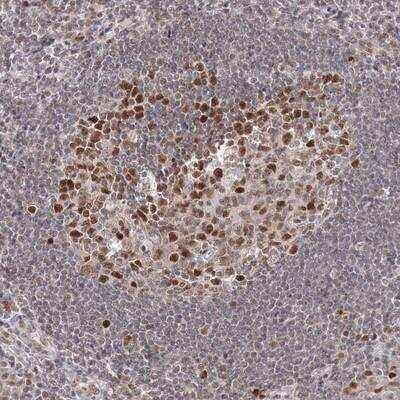 Immunohistochemistry-Paraffin: IWS1 Antibody [NBP1-94064]