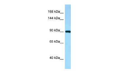 Western Blot: IWS1 Antibody [NBP2-85119]