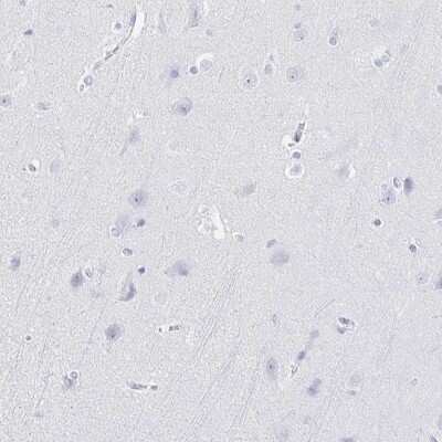 Immunohistochemistry-Paraffin: IYD Antibody [NBP2-31786]
