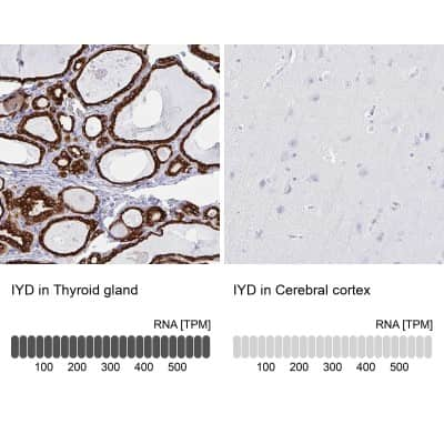 Western Blot: IYD Antibody [NBP2-31786]