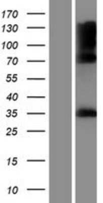 Western Blot: IYD Overexpression Lysate [NBP2-10140]