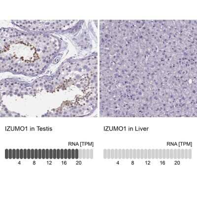 Immunohistochemistry-Paraffin: IZUMO1 Antibody [NBP1-83086]