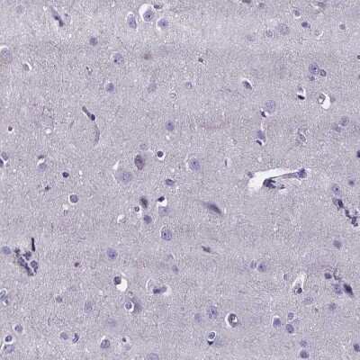 Immunohistochemistry-Paraffin: IZUMO1 Antibody [NBP1-83086]