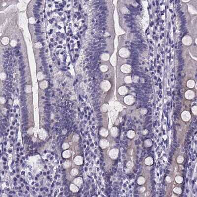 Immunohistochemistry-Paraffin: IZUMO1 Antibody [NBP1-83086]