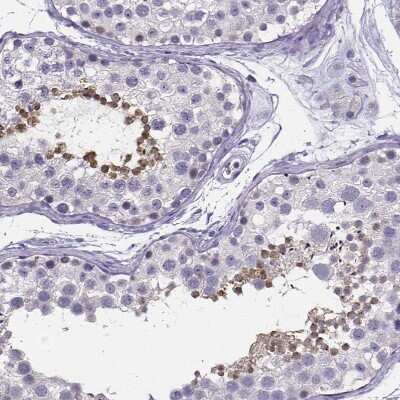 Immunohistochemistry-Paraffin: IZUMO1 Antibody [NBP1-83086]