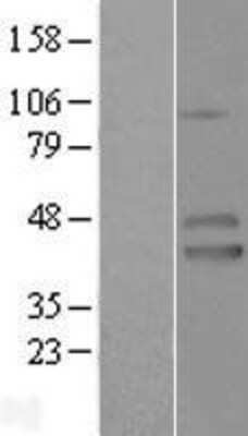 Western Blot: IZUMO1 Overexpression Lysate [NBL1-12090]