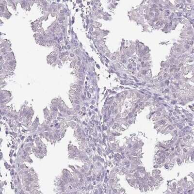 Immunohistochemistry-Paraffin: IZUMO4 Antibody [NBP2-30881]