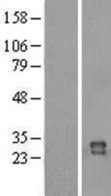 Western Blot: IZUMO4 Overexpression Lysate [NBL1-08270]