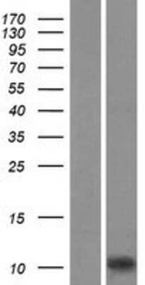 Western Blot: AIF-1/Iba1 Overexpression Lysate [NBL1-07408]