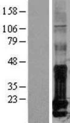 Western Blot: ID1 Overexpression Lysate [NBL1-11813]