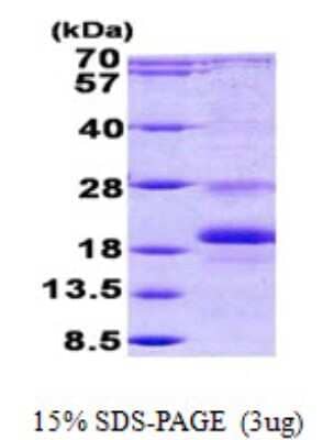 SDS-PAGE: Recombinant Human ID1 His Protein [NBP2-23138]