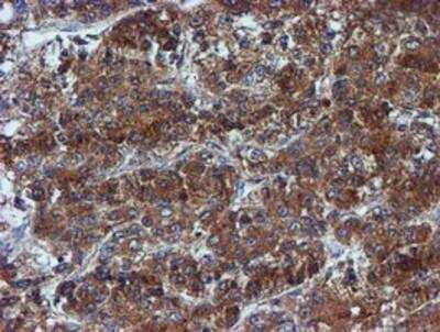Immunohistochemistry-Paraffin: Iduronate 2-Sulfatase/IDS Antibody (OTI1D9) [NBP2-01745]