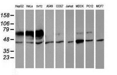 Western Blot: Iduronate 2-Sulfatase/IDS Antibody (OTI4G2) [NBP2-01761]