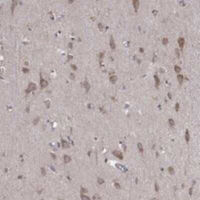 Immunohistochemistry-Paraffin: Iduronate 2-Sulfatase/IDS Antibody [NBP3-17659]