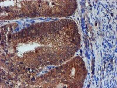 Immunohistochemistry: Iduronate 2-Sulfatase/IDS Antibody (OTI1D9) - Azide and BSA Free [NBP2-70994]