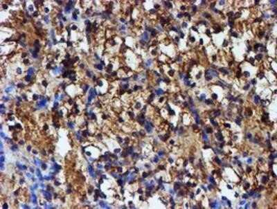 Immunohistochemistry: Iduronate 2-Sulfatase/IDS Antibody (OTI1D9) - Azide and BSA Free [NBP2-70994]