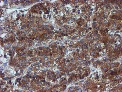 Immunohistochemistry: Iduronate 2-Sulfatase/IDS Antibody (OTI1D9) - Azide and BSA Free [NBP2-70994]