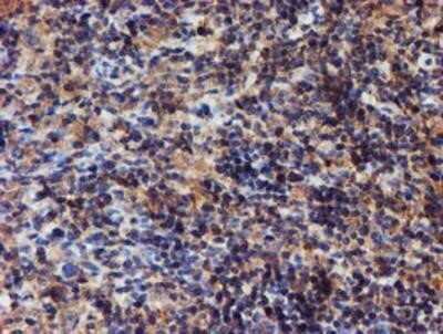 Immunohistochemistry: Iduronate 2-Sulfatase/IDS Antibody (OTI1D9) - Azide and BSA Free [NBP2-70994]