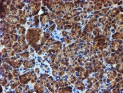 Immunohistochemistry: Iduronate 2-Sulfatase/IDS Antibody (OTI1D9) - Azide and BSA Free [NBP2-70994]