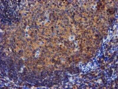 Immunohistochemistry: Iduronate 2-Sulfatase/IDS Antibody (OTI1D9) - Azide and BSA Free [NBP2-70994]