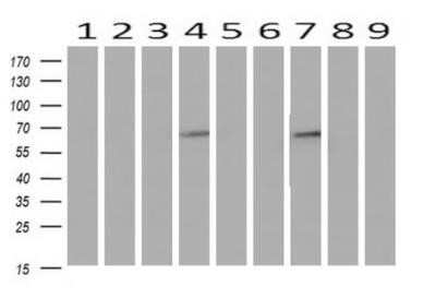 Western Blot: Iduronate 2-Sulfatase/IDS Antibody (OTI1D9)Azide and BSA Free [NBP2-70994]