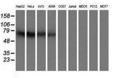 Western Blot: Iduronate 2-Sulfatase/IDS Antibody (OTI1D9)Azide and BSA Free [NBP2-70994]