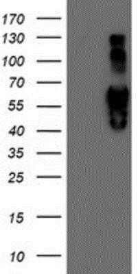 Western Blot: Iduronate 2-Sulfatase/IDS Antibody (OTI1D9)Azide and BSA Free [NBP2-70994]