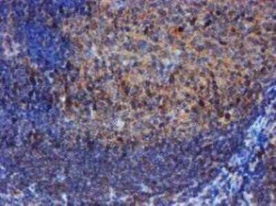 Immunohistochemistry: Iduronate 2-Sulfatase/IDS Antibody (OTI4G2) - Azide and BSA Free [NBP2-70996]