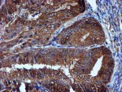 Immunohistochemistry: Iduronate 2-Sulfatase/IDS Antibody (OTI4G2) - Azide and BSA Free [NBP2-70996]