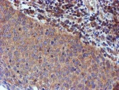 Immunohistochemistry: Iduronate 2-Sulfatase/IDS Antibody (OTI4G2) - Azide and BSA Free [NBP2-70996]
