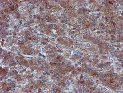 Immunohistochemistry: Iduronate 2-Sulfatase/IDS Antibody (OTI4G2) - Azide and BSA Free [NBP2-70996]