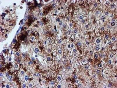 Immunohistochemistry: Iduronate 2-Sulfatase/IDS Antibody (OTI4G2) - Azide and BSA Free [NBP2-70996]