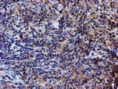 Immunohistochemistry: Iduronate 2-Sulfatase/IDS Antibody (OTI4G2) - Azide and BSA Free [NBP2-70996]