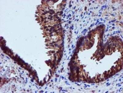 Immunohistochemistry: Iduronate 2-Sulfatase/IDS Antibody (OTI4G2) - Azide and BSA Free [NBP2-70996]
