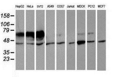 Western Blot: Iduronate 2-Sulfatase/IDS Antibody (OTI4G2)Azide and BSA Free [NBP2-70996]