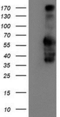 Western Blot: Iduronate 2-Sulfatase/IDS Antibody (OTI4G2)Azide and BSA Free [NBP2-70996]