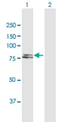 Western Blot: Iduronate 2-Sulfatase/IDS Antibody [H00003423-D01P]