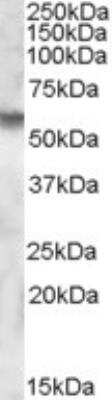 Western Blot: Iduronate 2-Sulfatase/IDS Antibody [NBP1-28477]