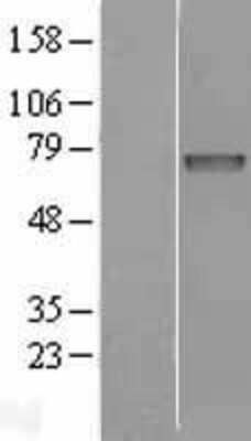 Western Blot: Iduronate 2-Sulfatase/IDS Overexpression Lysate [NBL1-11823]