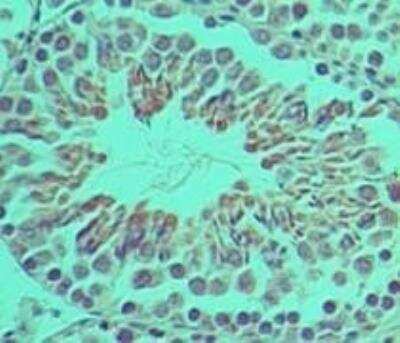 Immunohistochemistry-Paraffin: Ifi204 Antibody [NBP2-27153]