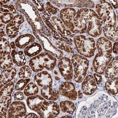 Immunohistochemistry-Paraffin: Ift80 Antibody [NBP1-92020]