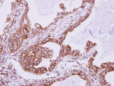 Immunohistochemistry-Paraffin: Ift80 Antibody [NBP2-16927]