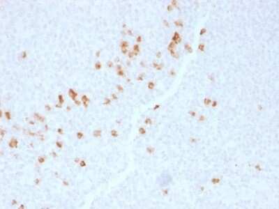 Immunohistochemistry-Paraffin: Ig gamma-4 Chain C Region Antibody (IGHG4/1345) [NBP2-53218]