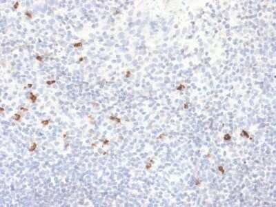 Immunohistochemistry-Paraffin: Ig gamma-4 Chain C Region Antibody (IGHG4/2042R) - Azide and BSA Free [NBP2-79850]