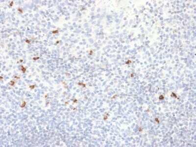 Immunohistochemistry-Paraffin: Ig gamma-4 Chain C Region Antibody (IGHG4/2042R) [NBP2-79716]