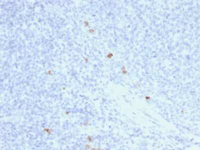 Immunohistochemistry-Paraffin: Ig gamma-4 Chain C Region Antibody (rIGHG4/1345) - Azide and BSA Free [NBP3-08668]