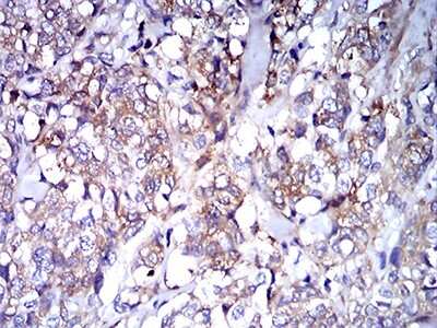 Immunohistochemistry-Paraffin: IgA Antibody (7D5F12) - BSA Free [NBP2-61794]