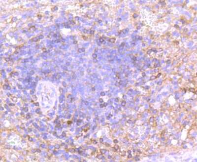 Immunohistochemistry-Paraffin: IgA Antibody (JM10-42) [NBP2-66901]
