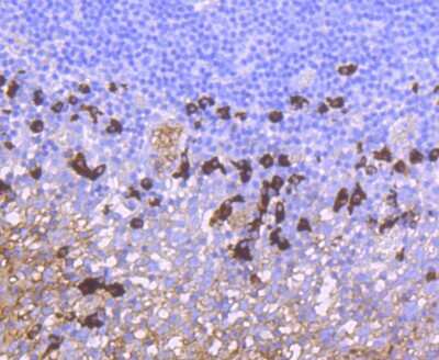 Immunohistochemistry-Paraffin: IgA Antibody (JM10-42) [NBP2-66901]